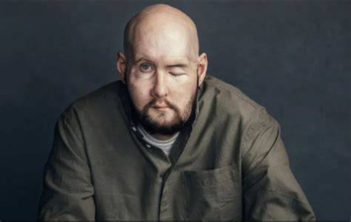 Aaron James Accident Update