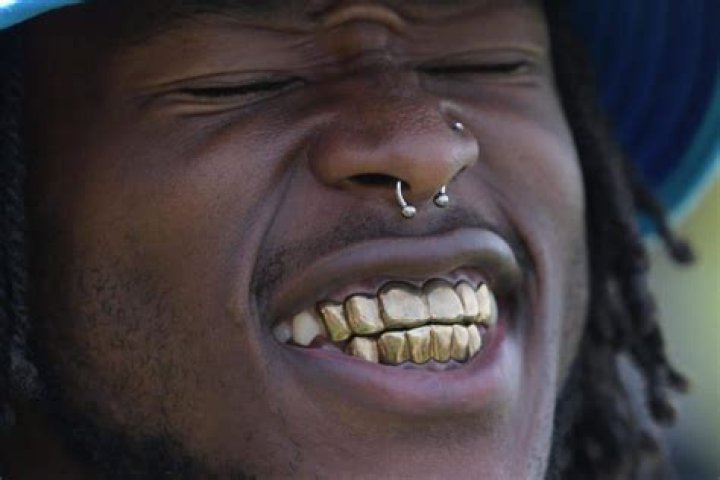Alvin Kamara wearing 18 carat gold grills 