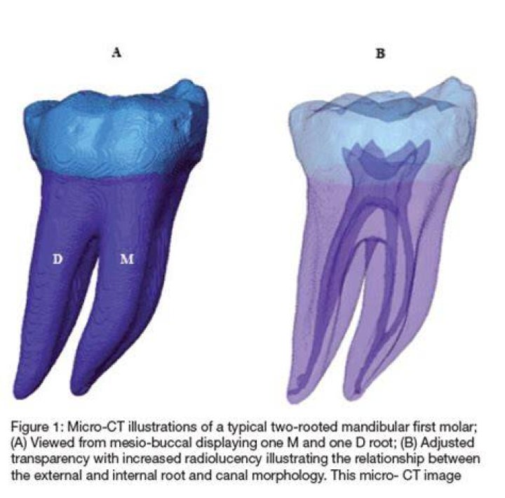 How many roots mandibular first molar?