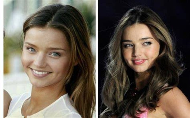 Miranda Kerr nose job
