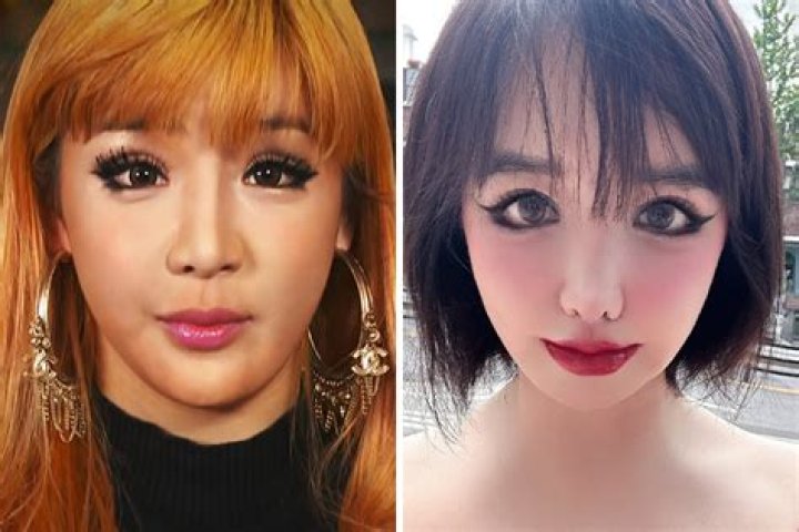 Park Bom before and after plastic surgery