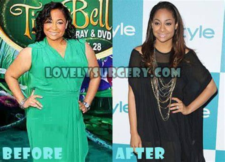 Raven Symone Plastic Surgery