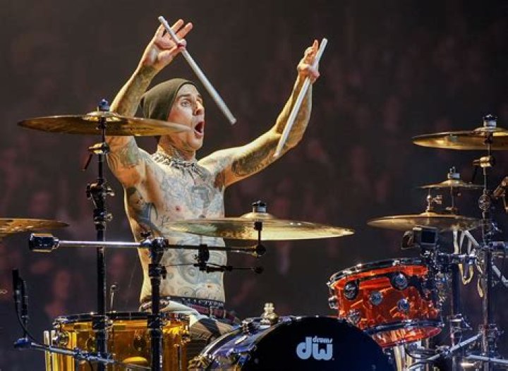 ‘Another Hand Injury!’ Travis Barker Broke His Ring Finger for the Second Time in Less Than Two Weeks! Travis Barker